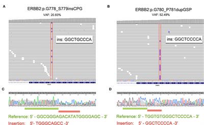 <mark class="highlighted">HER2 Exon 20 Insertion</mark> Mutations in Lung Adenocarcinoma: Case Series and Response to Pyrotinib